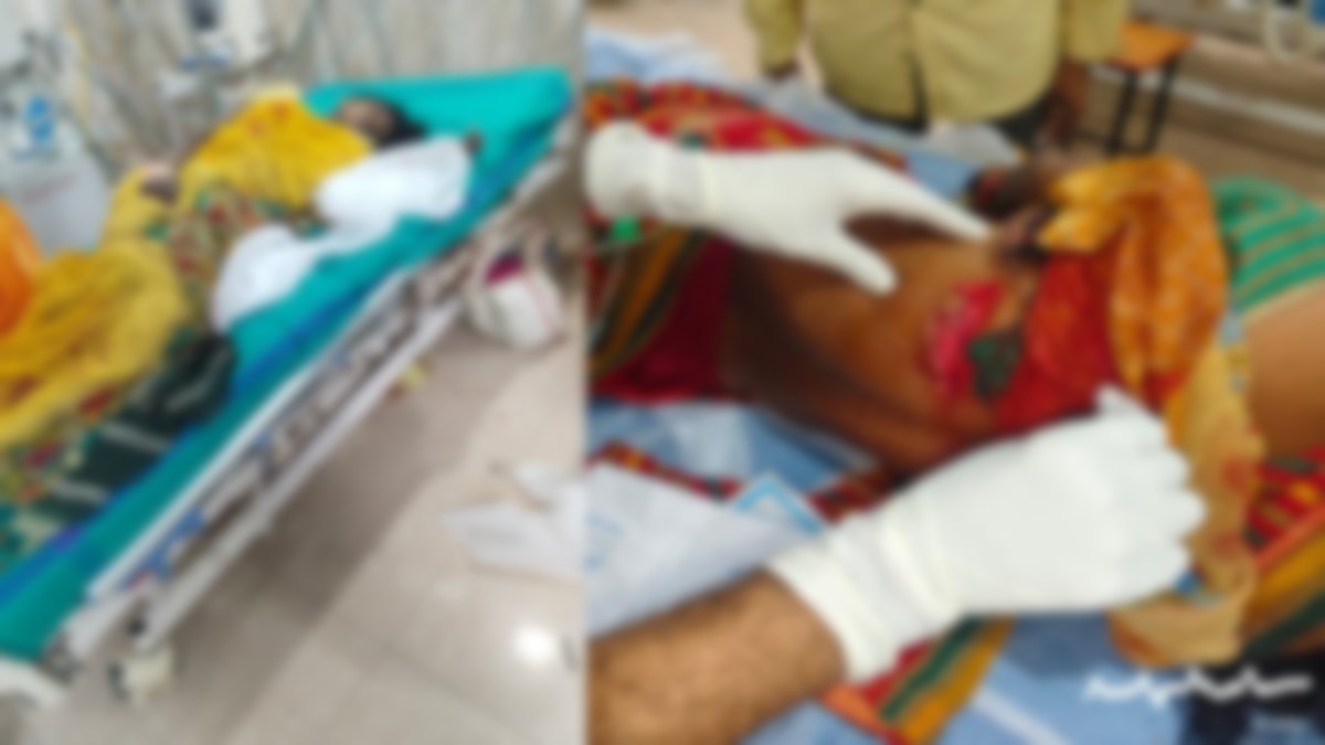 कोहलाकसा के जंगल में तेंदूपत्ता तोडऩे गई महिलाओं पर सूअर ने किया हमला, 5 गंभीर, एक ही हालत नाजुक