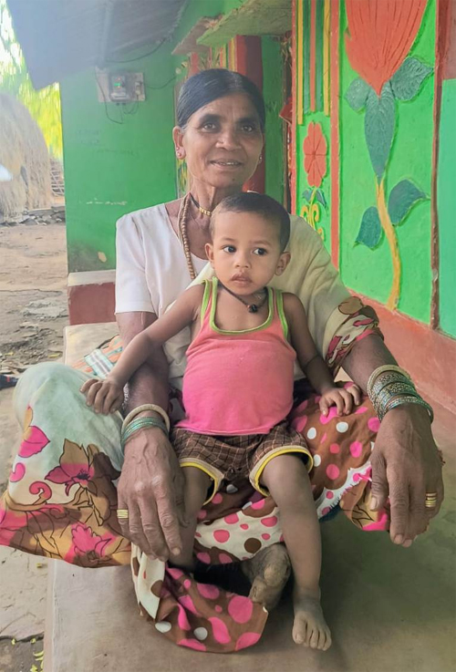 जन्म से बंद थे मलद्वार और मूत्र मार्ग, दो सफल ऑपरेशनों ने बदली तीन वर्षीय अरुलेश की जिंदगी