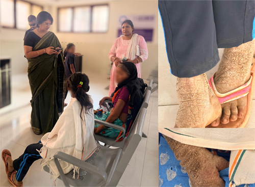 डॉ .वर्णिका की पहल से गंभीर रूप से बीमार बालिका जोगेश्वरी को मिला एम्स रायपुर में उपचार 